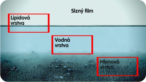 [design/2012/Slzn%C3%BD%20filmweb.jpg]